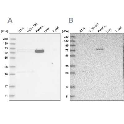 Western Blot: LRRC45 Antibody [NBP1-93510]
