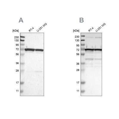 Western Blot: LRRC47 Antibody [NBP1-93597]