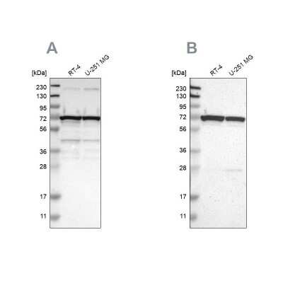 Western Blot: LRRC47 Antibody [NBP1-93598]