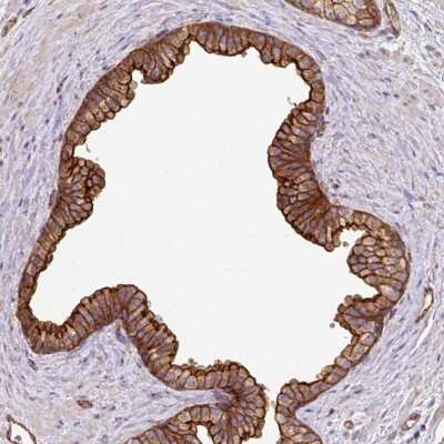 Immunohistochemistry: LRRC53 Antibody [NBP2-49112]