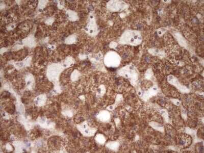 Immunohistochemistry: LRRC6 Antibody (OTI7E9) [NBP2-45674]