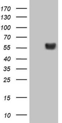 Western Blot: LRRC6 Antibody (OTI7E9) [NBP2-45674]