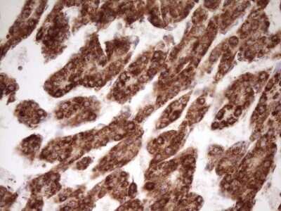 Immunohistochemistry: LRRC6 Antibody (OTI7E9) - Azide and BSA Free [NBP2-72542]