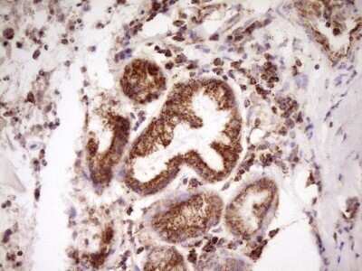Immunohistochemistry: LRRC6 Antibody (OTI7E9) - Azide and BSA Free [NBP2-72542]