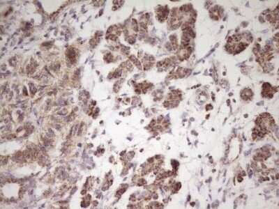 Immunohistochemistry: LRRC6 Antibody (OTI7E9) - Azide and BSA Free [NBP2-72542]