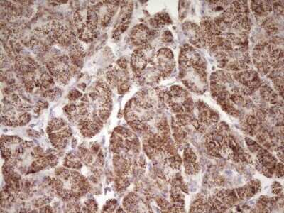 Immunohistochemistry: LRRC6 Antibody (OTI7E9) - Azide and BSA Free [NBP2-72542]