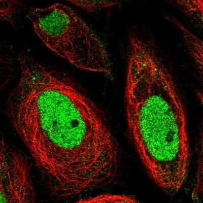 Immunocytochemistry/ Immunofluorescence: LRRC61 Antibody [NBP1-82021]
