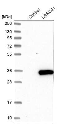 Western Blot: LRRC61 Antibody [NBP1-82021]