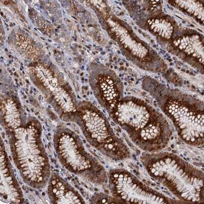 Immunohistochemistry-Paraffin: LRRC63 Antibody [NBP1-90670]