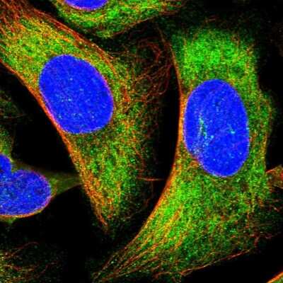Immunocytochemistry/ Immunofluorescence: LRRC68 Antibody [NBP1-90889]