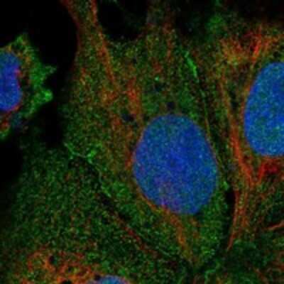 Immunocytochemistry/ Immunofluorescence: LRRC9 Antibody [NBP3-17513]