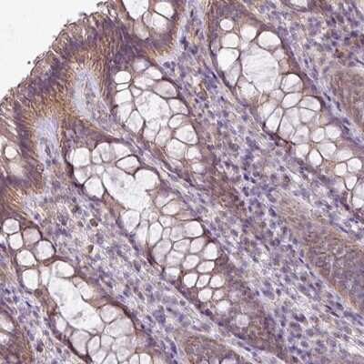 Immunohistochemistry-Paraffin: LRRC9 Antibody [NBP2-34176]