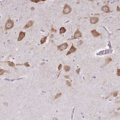 Immunohistochemistry-Paraffin: LRRC9 Antibody [NBP2-34177]