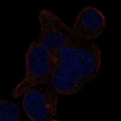 Immunocytochemistry/ Immunofluorescence: LRRCC1 Antibody [NBP3-17600]