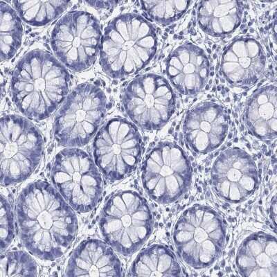 Immunohistochemistry-Paraffin: LRRD1 Antibody [NBP3-16965]