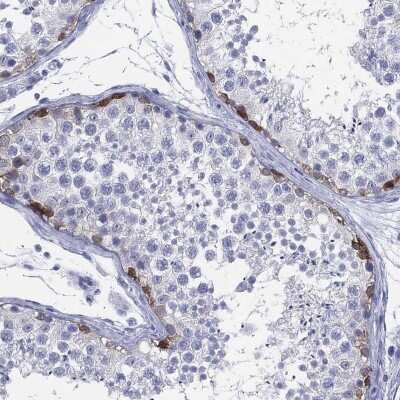 Immunohistochemistry-Paraffin: LRRD1 Antibody [NBP3-16965]