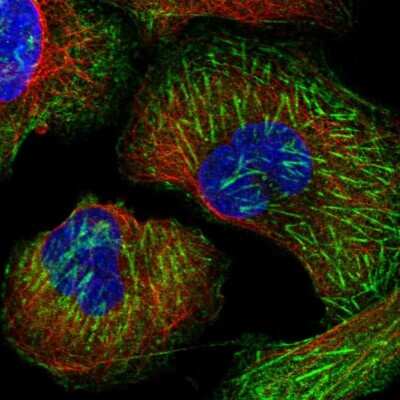 Immunocytochemistry/ Immunofluorescence: LRRFIP2 Antibody [NBP2-58998]