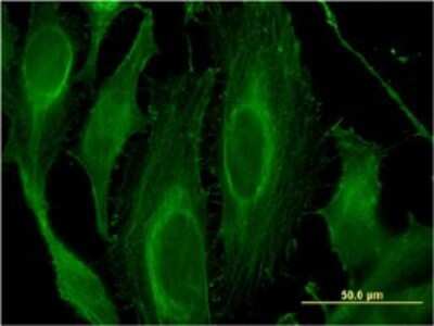 Immunocytochemistry/ Immunofluorescence: LRRK1 Antibody (3G8) [H00079705-M03]