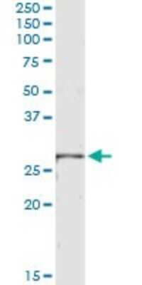 Immunoprecipitation: LRRK1 Antibody (3G8) [H00079705-M03]