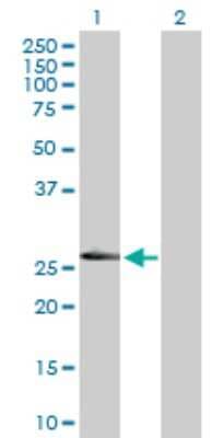 Western Blot: LRRK1 Antibody [H00079705-D01P]