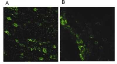 Immunocytochemistry/ Immunofluorescence: LRRK2 Antibody [NB110-58771]