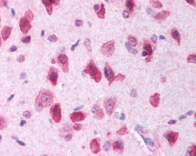 Immunohistochemistry: LRRK2 Antibody [NB110-55289]