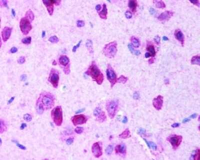 Immunohistochemistry: LRRK2 Antibody Pack [NB100-938]