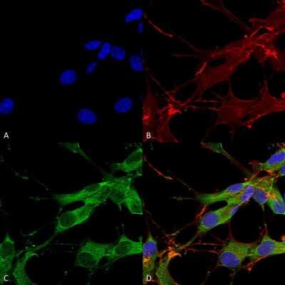 Immunocytochemistry/ Immunofluorescence: LRRK2 Antibody (S138-6) [NBP2-42175]
