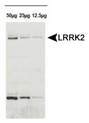Western Blot: LRRK2 Antibody [NB110-58771]