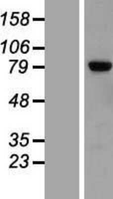 Western Blot: LRRN2 Overexpression Lysate [NBL1-12712]