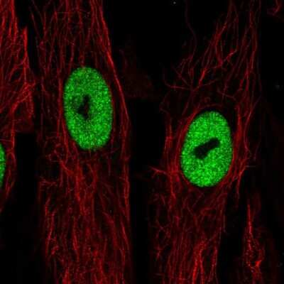Immunocytochemistry/ Immunofluorescence: LRRN4CL Antibody [NBP2-30871]