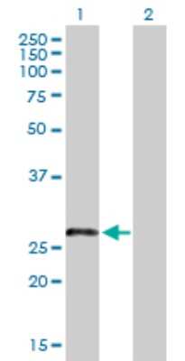 Western Blot: LRRN4CL Antibody [H00221091-B01P]