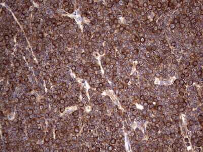 Immunohistochemistry: LRRTM1 Antibody (OTI5H9) [NBP2-45675]