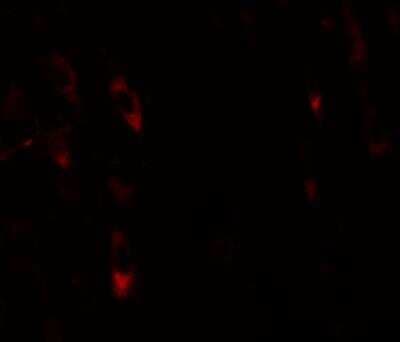 Immunocytochemistry/ Immunofluorescence: LRRTM1 Antibody - BSA Free [NBP1-76528]