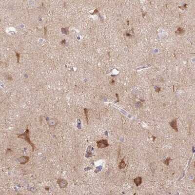 Immunohistochemistry: LRRTM1 Antibody [NBP2-37998]