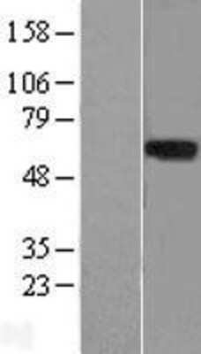 Western Blot: LRRTM1 Overexpression Lysate [NBL1-12714]