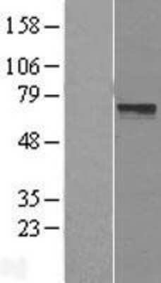 Western Blot: LRRTM3 Overexpression Lysate [NBL1-12715]