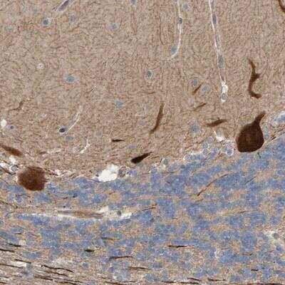 Immunohistochemistry-Paraffin: LRSAM1 Antibody [NBP1-82017]