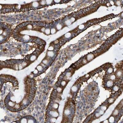 Immunohistochemistry-Paraffin: LRSAM1 Antibody [NBP1-82016]