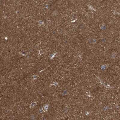 Immunohistochemistry-Paraffin: LRSAM1 Antibody [NBP1-82016]