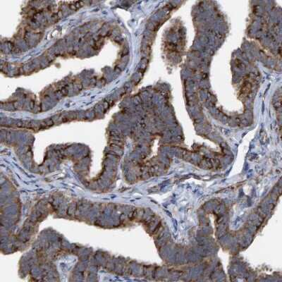 Immunohistochemistry-Paraffin: LRSAM1 Antibody [NBP1-82016]