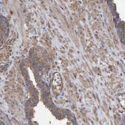 Immunohistochemistry-Paraffin: LRSAM1 Antibody [NBP1-82016]