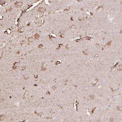 Immunohistochemistry-Paraffin: LRTM2 Antibody [NBP2-30649]