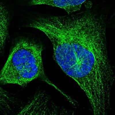 Immunocytochemistry/ Immunofluorescence: LRTOMT Antibody [NBP1-92081]