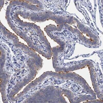 Immunohistochemistry-Paraffin: LRTOMT Antibody [NBP1-92081]