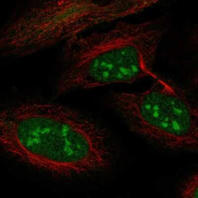 Immunocytochemistry/ Immunofluorescence: LRWD1 Antibody [NBP1-85113]