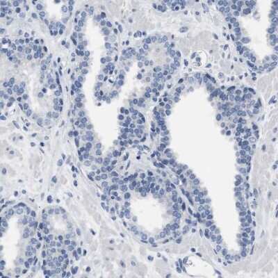 Immunohistochemistry-Paraffin: LRWD1 Antibody [NBP1-85113]