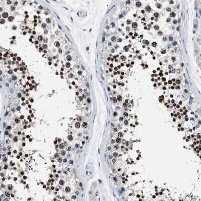 Immunohistochemistry-Paraffin: LRWD1 Antibody [NBP1-85113]