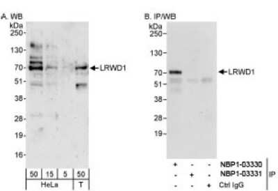 Western Blot: LRWD1 Antibody [NBP1-03331]