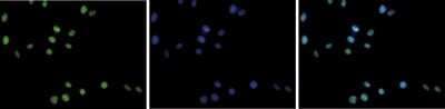 Immunocytochemistry/ Immunofluorescence: LSD1 Antibody [NBP3-18684]